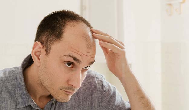 Man checking his thinned hair patch | Overview | How to Tell if Your Hair is Thinning