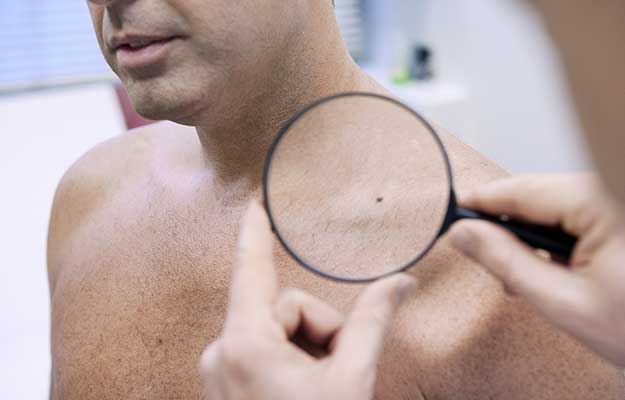 Dermatology-Consultation-Man | 9 Preventive Health Screening Tests For Men