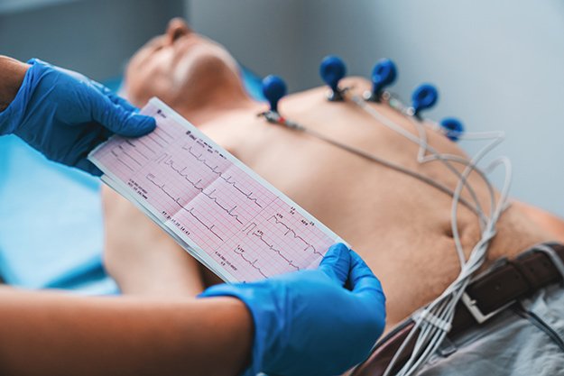 Ardiogram printout Diagnosis and Treatment For Atherosclerosis