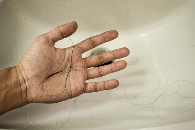 Excessive hair shed in the sink | Tell-Tale Sign that Your Hair is Thinning | How to Tell if Your Hair is Thinning