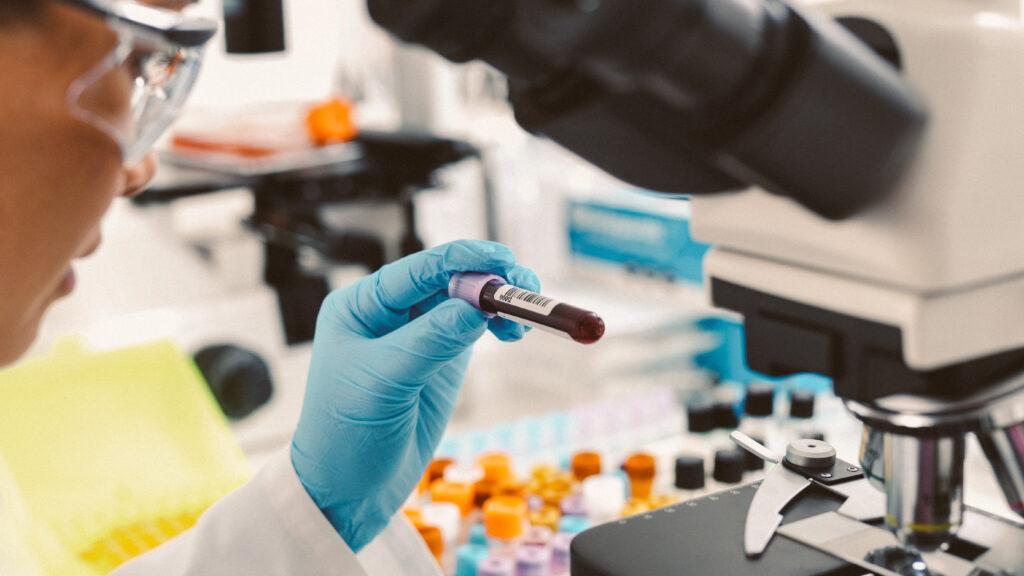 Blood samples for peptide lab testing