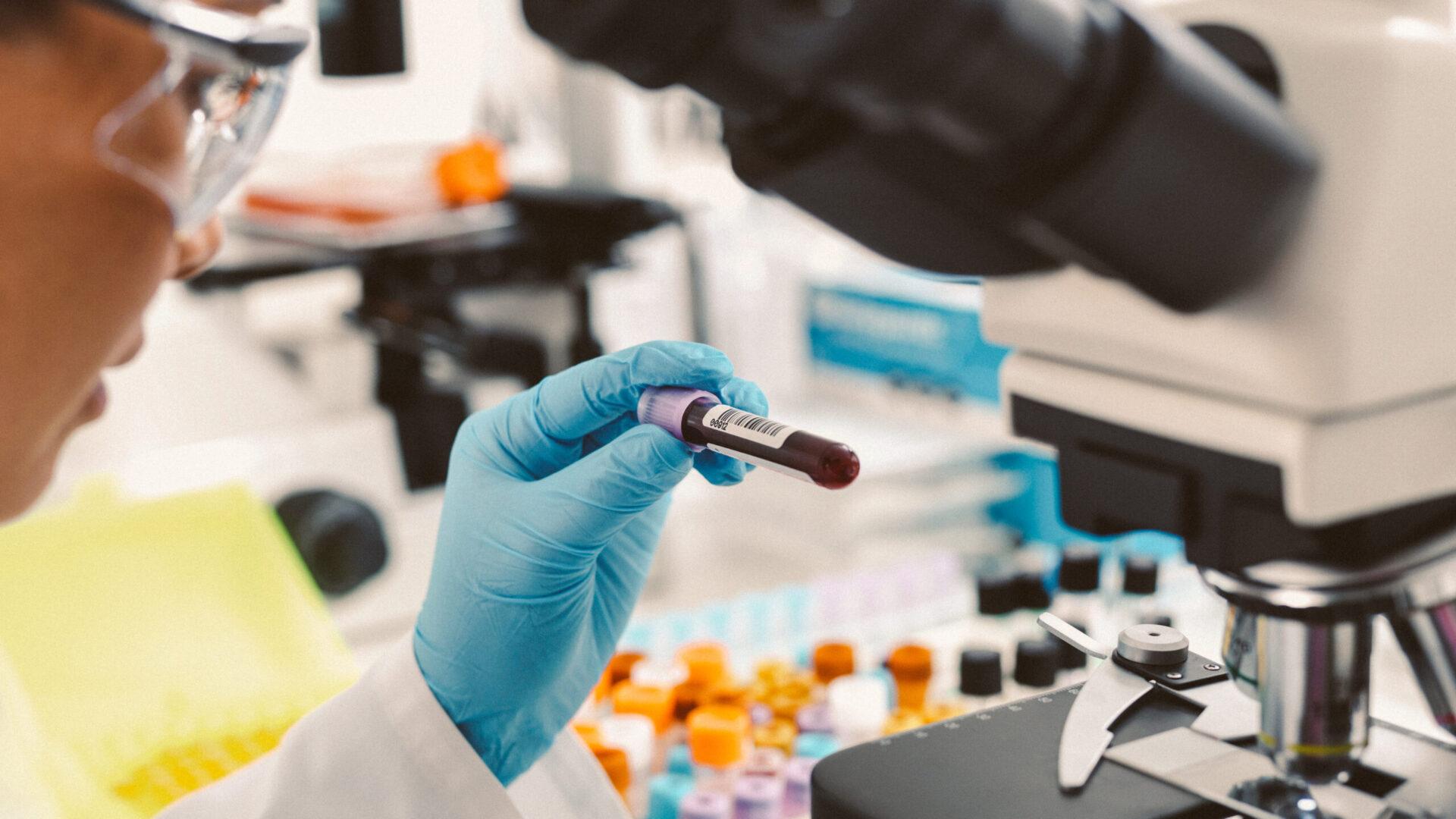 Blood sample vials for baseline biomarker testing