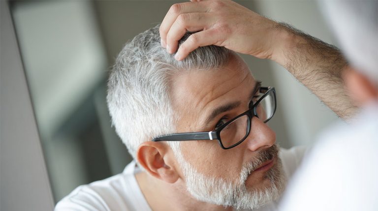 man-concerned-by-hair-loss-How-Do-DHT-Blockers-Work-In-Reversing-Hair-Loss-ss-feature | How Do DHT Blockers Work In Reversing Hair Loss?