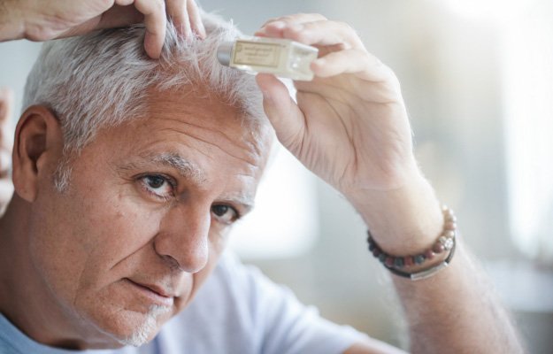 Senior man treating hair loss | Why Is My Hair Falling Out? Hair Loss Causes & Treatments